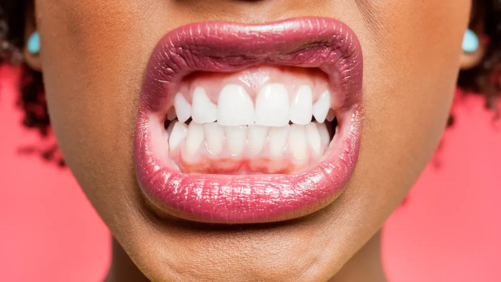 Persona con tensión mandibular y dolor en la articulación temporomandibular